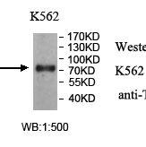 TTC25 Antibody