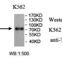 TTC25 Antibody