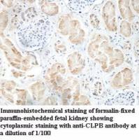 CLPB Antibody