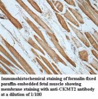 CKMT2 Antibody