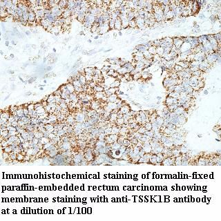 TSSK1B Antibody