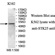 STK25 Antibody