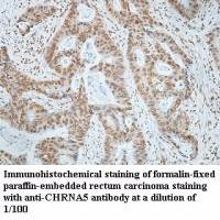 CHRNA5 Antibody