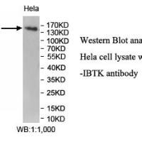 IBTK Antibody