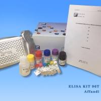 Human GDF9(Growth Differentiation Factor 9) ELISA Kit