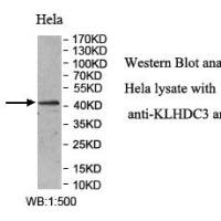 KLHDC3 Antibody