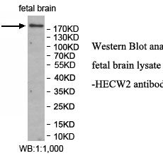 HECW2 Antibody