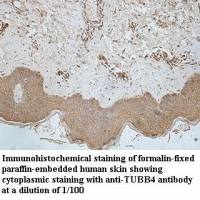 TUBB4 Antibody