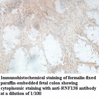 RNF138 Antibody