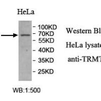 TRMT2A Antibody