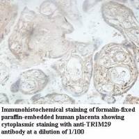 TRIM29 Antibody