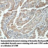 CPB1 Antibody