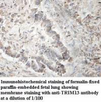 TRIM13 Antibody