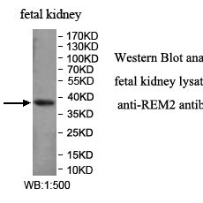 REM2 Antibody