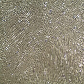 Wharton's jelly人脐血间充质干细胞