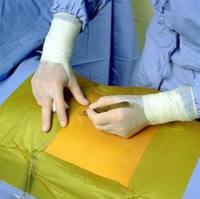 3M 含碘抗菌手术薄膜 6640、6650