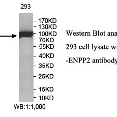 ENPP2 Antibody