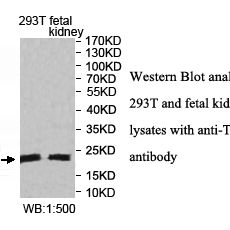 TXNL4B Antibody