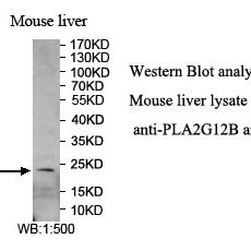 PLA2G12B Antibody