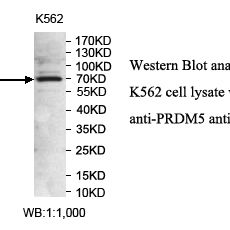 PRDM5 Antibody