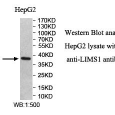 LIMS1 Antibody