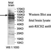 RICH2 Antibody