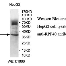 RPP40 Antibody