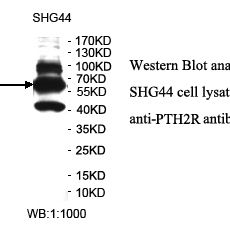 PTH2R Antibody