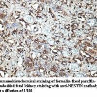 NESTIN Antibody