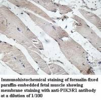 PIK3R1 Antibody