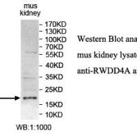 RWDD4A Antibody