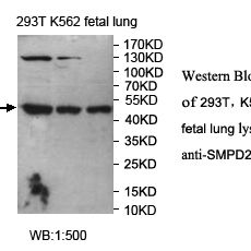SMPD2 Antibody