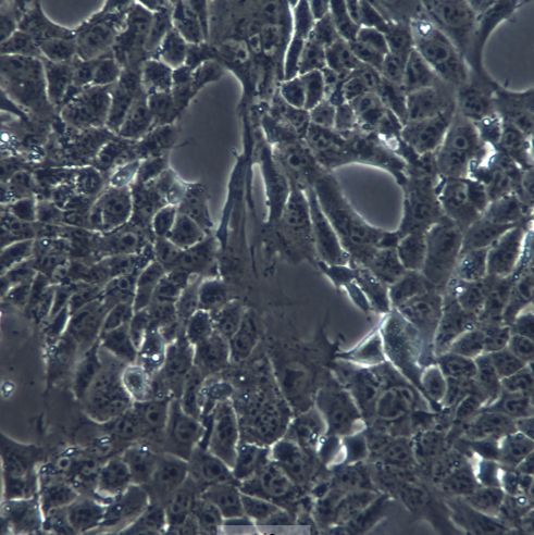 小鼠乳腺癌细胞，4T1