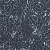 小鼠乳腺癌细胞，4T1