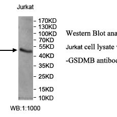 GSDMB Antibody