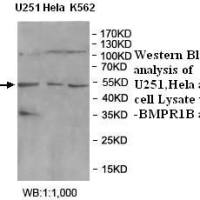 BMPR1B Antibody
