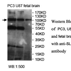 SLITRK5 Antibody