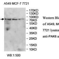 PAK6 Antibody