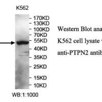 PTPN2 Antibody