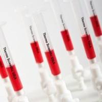 Thermo Scientific™ SOLA™ SPE 纯化柱60109-001