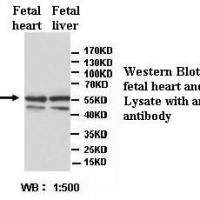 ATP5B Antibody
