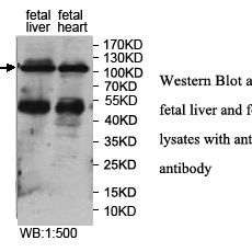 JHDM1D Antibody