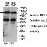 JHDM1D Antibody