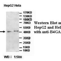 B4GALT3 Antibody