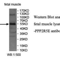 PPP2R5E Antibody
