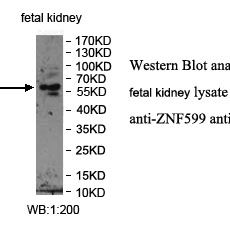 ZNF599 Antibody