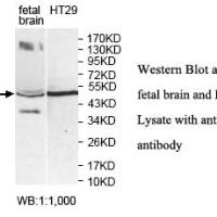 MBD2 Antibody