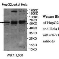 YTHDF2 Antibody