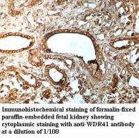 WDR41 Antibody