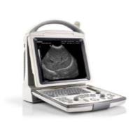 DP－30超声诊断仪